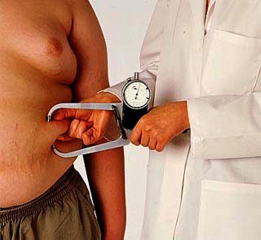 Saúde publica novas diretrizes para o tratamento da obesidade