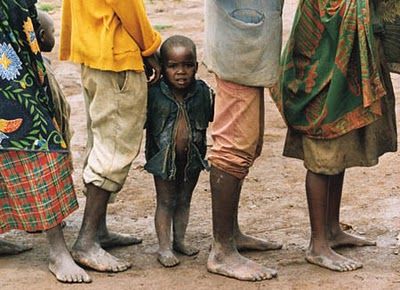 Melhora na situação da infância não é uniforme em países pobres, diz Unicef