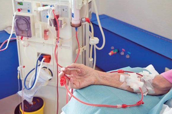 Saúde amplia tratamento para doentes renais crônicos