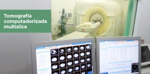 Hospital Infantil Albert Sabin implanta novo aparelho de tomografia